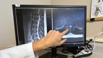 Dr. Maloney pointing out the 2- to 3-centimeter tumor on Palma's MRI.