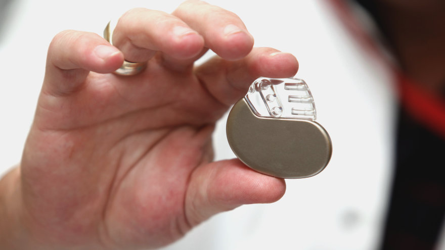 A doctor holding up a pacemaker.